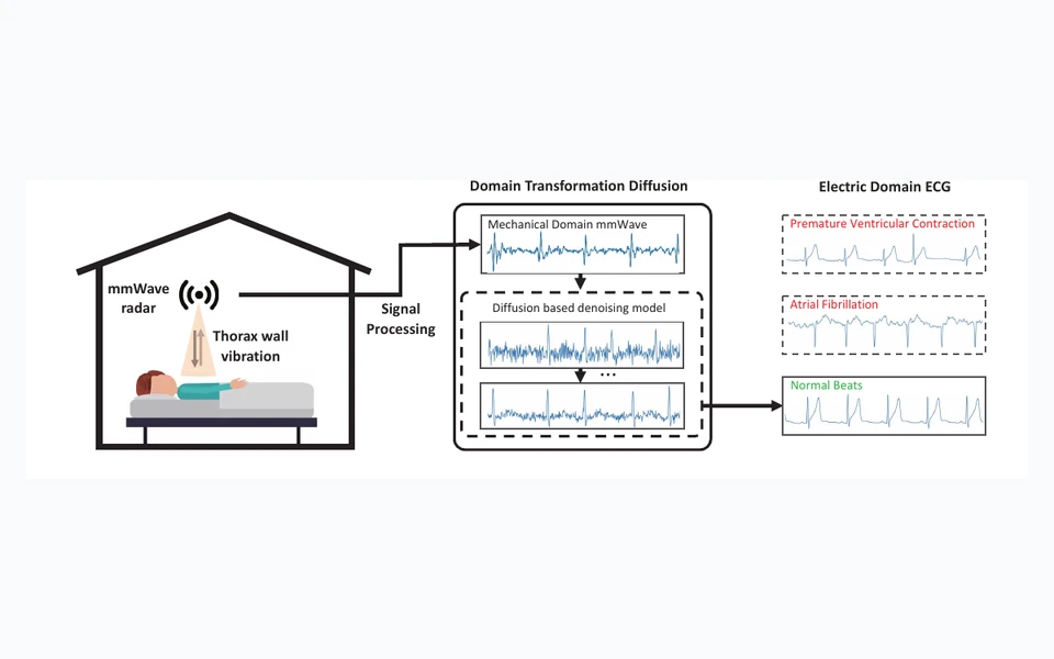 AirECG: Contactless Electrocardiogram for Cardiac Disease Monitoring via mmWave Sensing and Cross-domain Diffusion Model